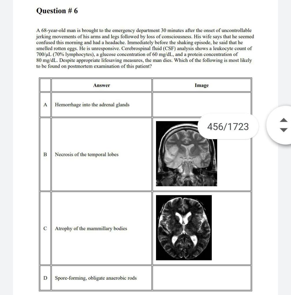 Solved Question #6 A 68-year-old man is brought to the | Chegg.com