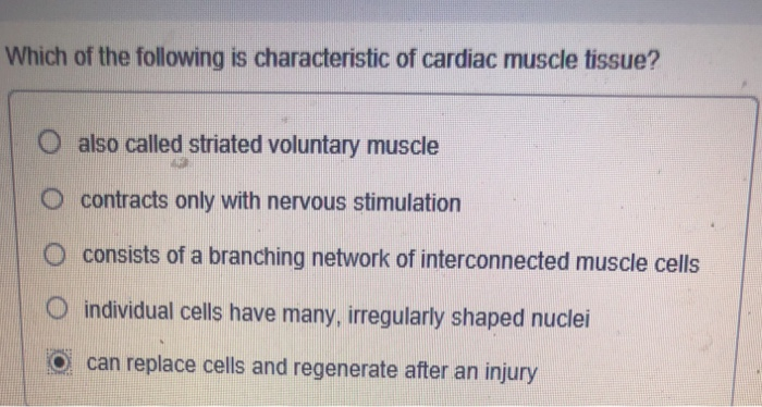 solved-which-of-the-following-is-characteristic-of-cardiac-chegg