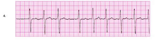 Solved Label the arrhythmia type on the EKG strip: (No | Chegg.com