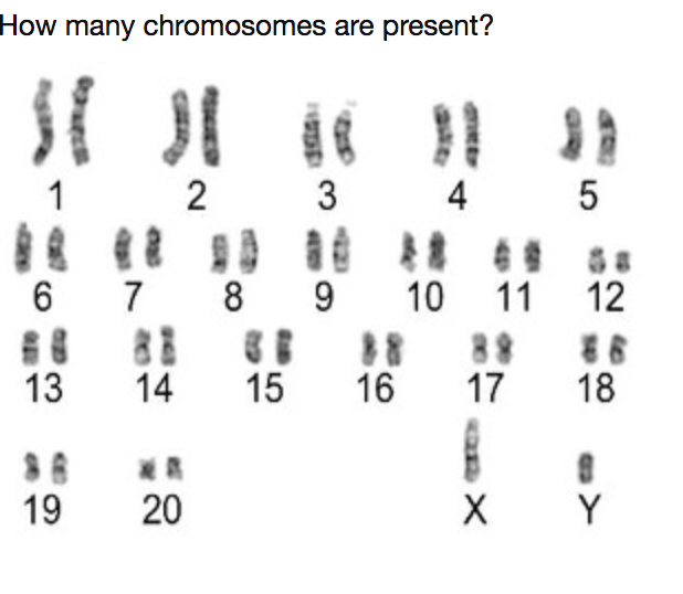 Solved how many chromosomes are present? and how many | Chegg.com