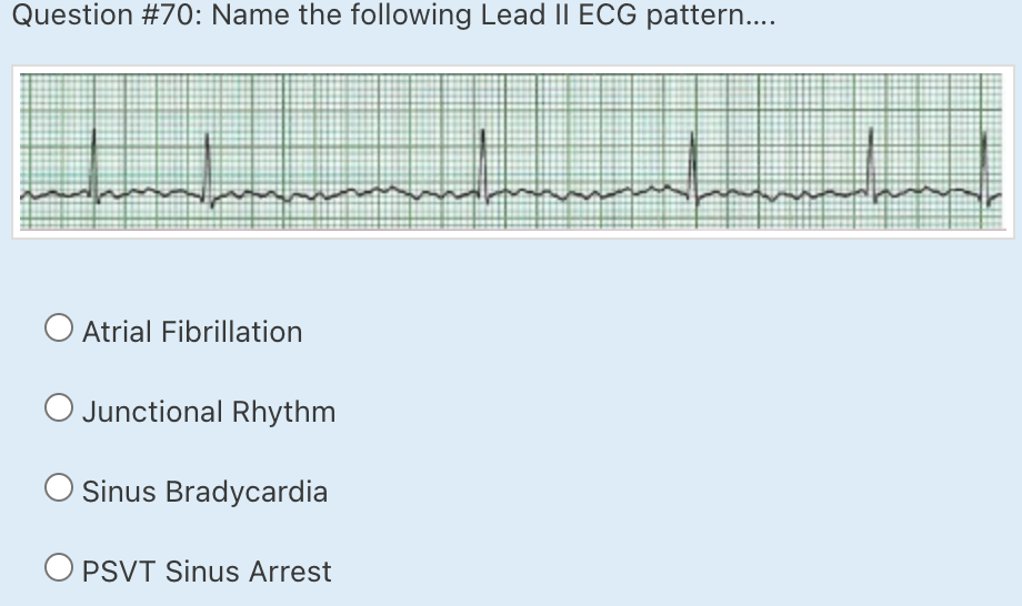 Solved Question #62: Identify The Following Lead II ECG | Chegg.com