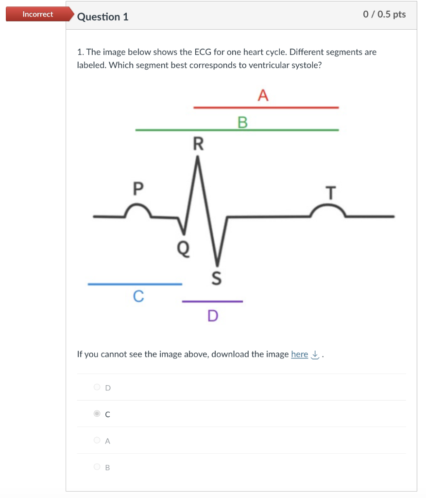 Solved 1. The image below shows the ECG for one heart cycle. | Chegg.com