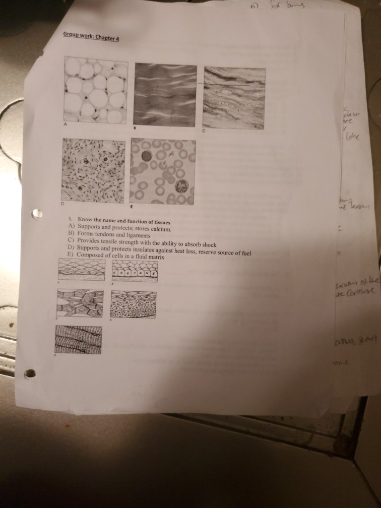 Solved D Reticular Connective Tissue Invades The Area 13 Chegg Com