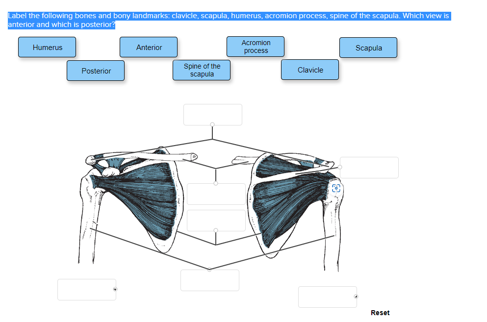 Solved Label the following bones and bony landmarks: | Chegg.com