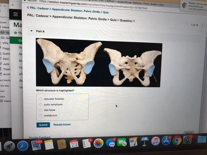 Solved: AL! Cadaver> Appendicular Skeleton: Pelvic Girdle ... | Chegg.com