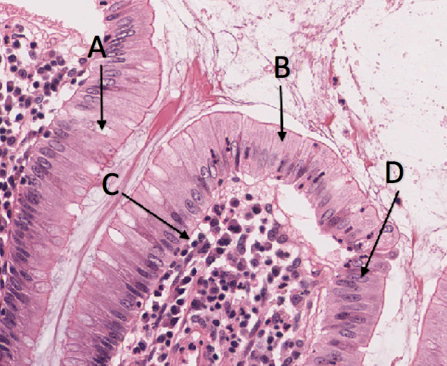 Solved Four Basic Tissue Types · Epithelial · 