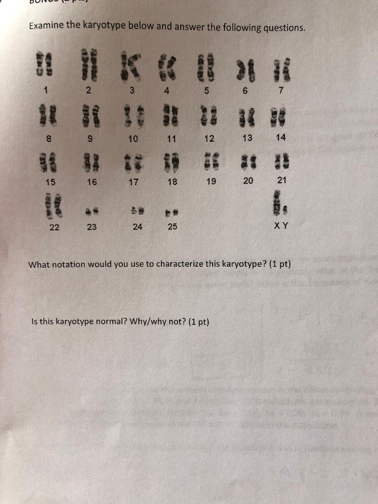 Solved Examine The Karyotype Below And Answer The Following | Chegg.com