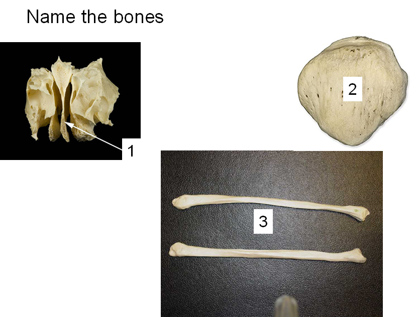 Solved Name the bones | Chegg.com
