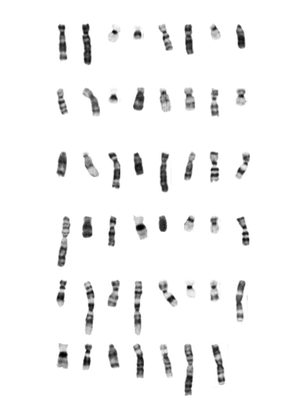 Solved alignment the chromosome with their partner and put Biology Diagrams