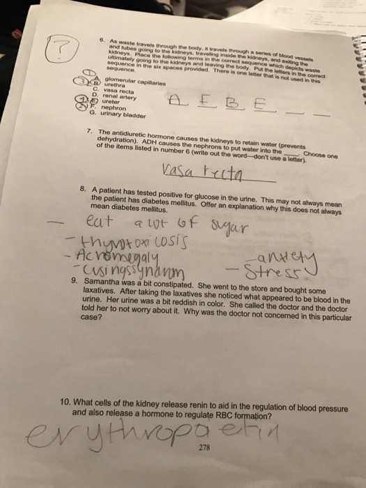 Solved URINALYSIS Name CHAPTER 18 1. Diabetes insipidus will