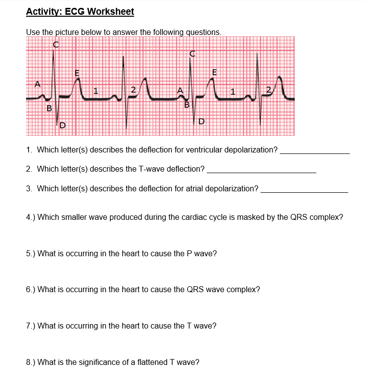 Solved Activity ECG Worksheet Use the picture below to