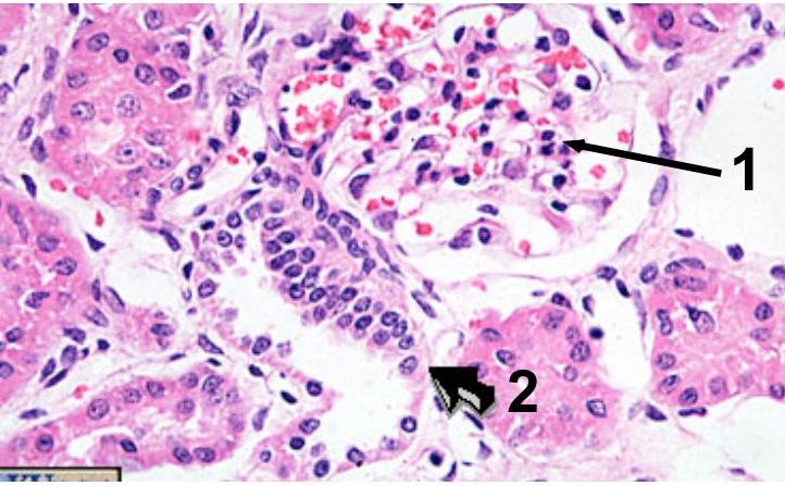 Solved This is a renal cortex please tell me what the | Chegg.com