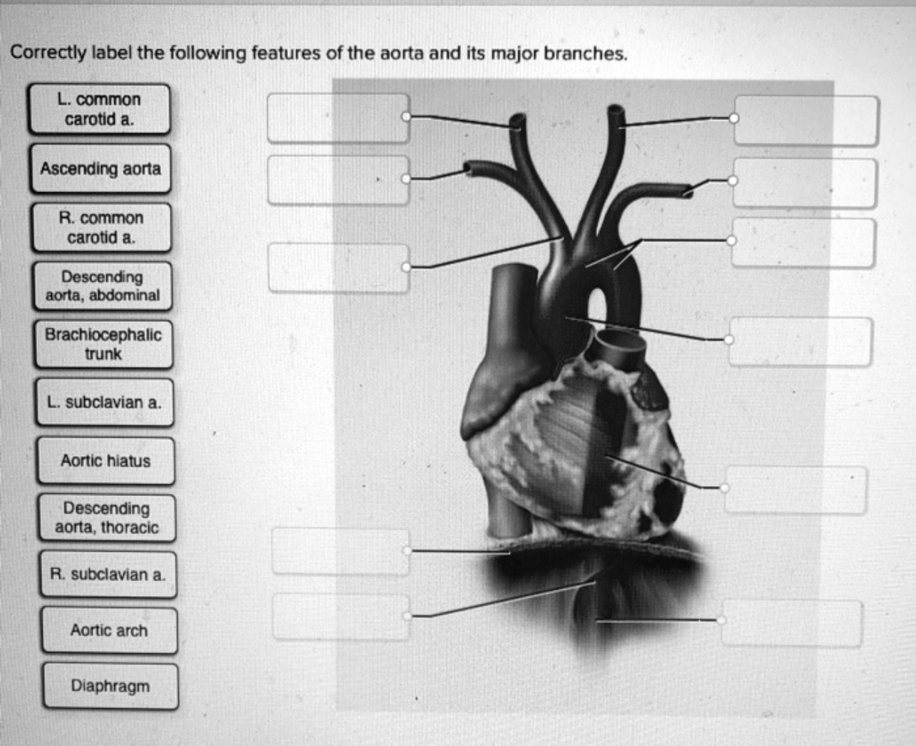 Solved Correctly label the following features of the aorta | Chegg.com