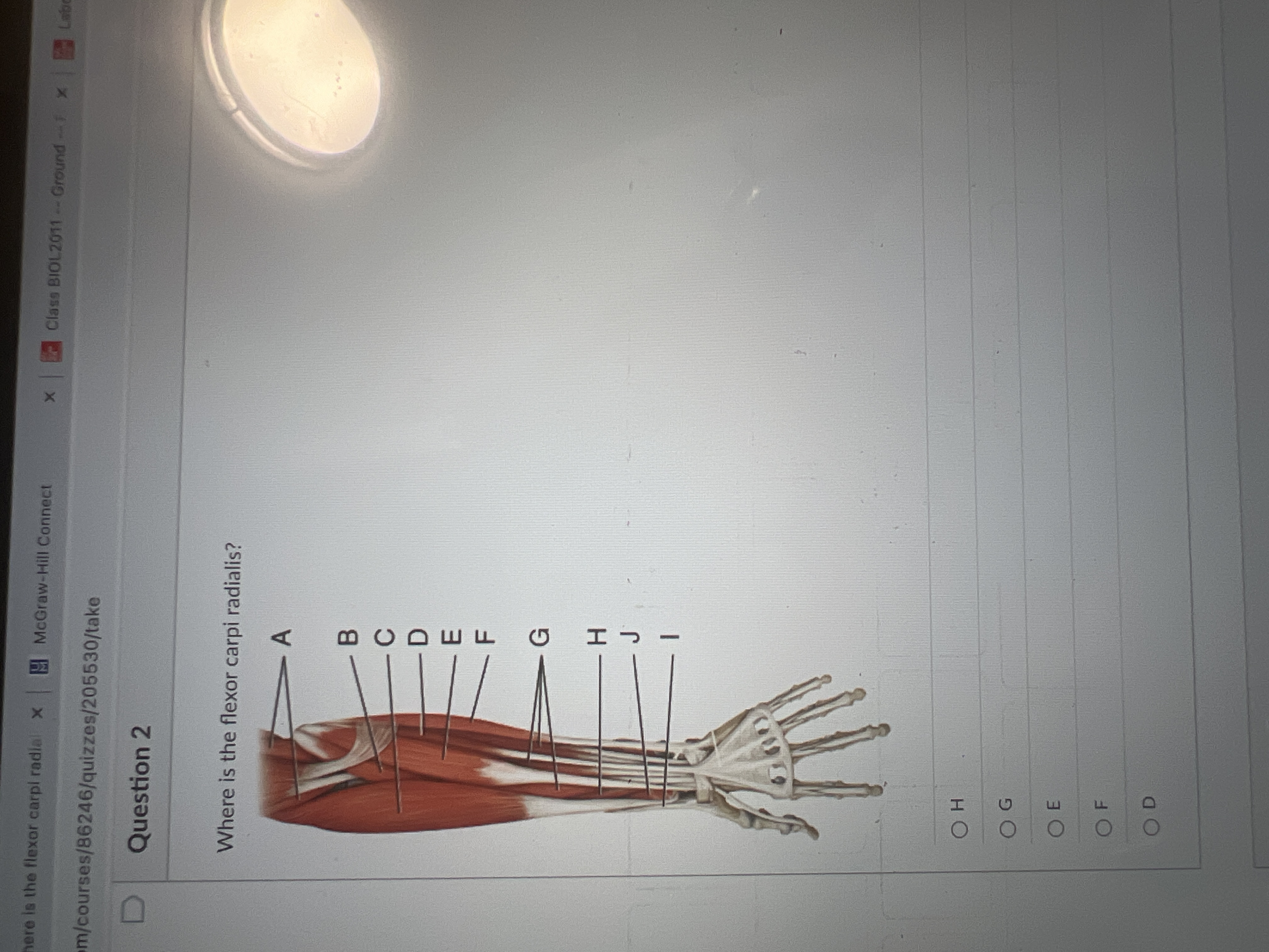 Solved Where is the flexor carpi radialis? | Chegg.com