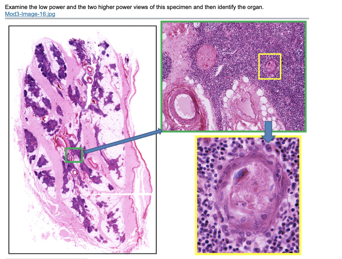 Examine the low power and the two higher power views of this specimen and then identify the organ.
Mod3-Image-16.jpg