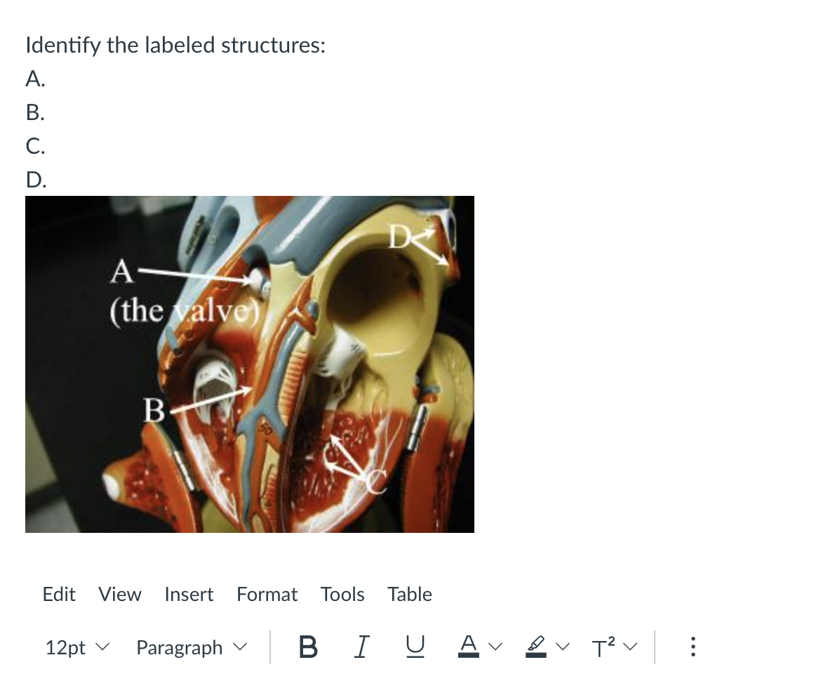 Solved Identify The Labeled Structures: A. B. C. D. | Chegg.com