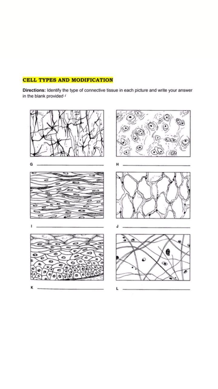 Solved Directions: Identify The Type Of Connective Tissue In | Chegg.com