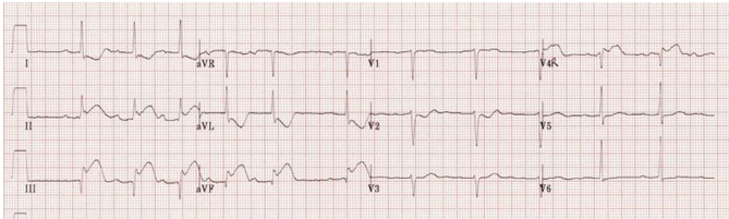 لے لی 1 SVR VI VAR اس باما 11 * 2 V5 اماما - III 13 V6