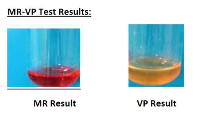 Solved MR, color and +/-: _____________________ VP, color | Chegg.com