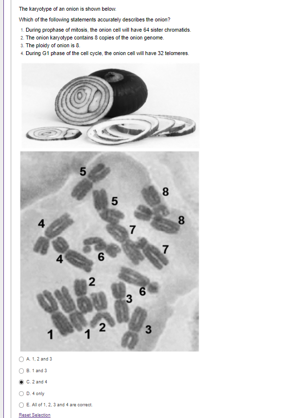 Solved The Karyotype Of An Onion Is Shown Below. Which Of | Chegg.com