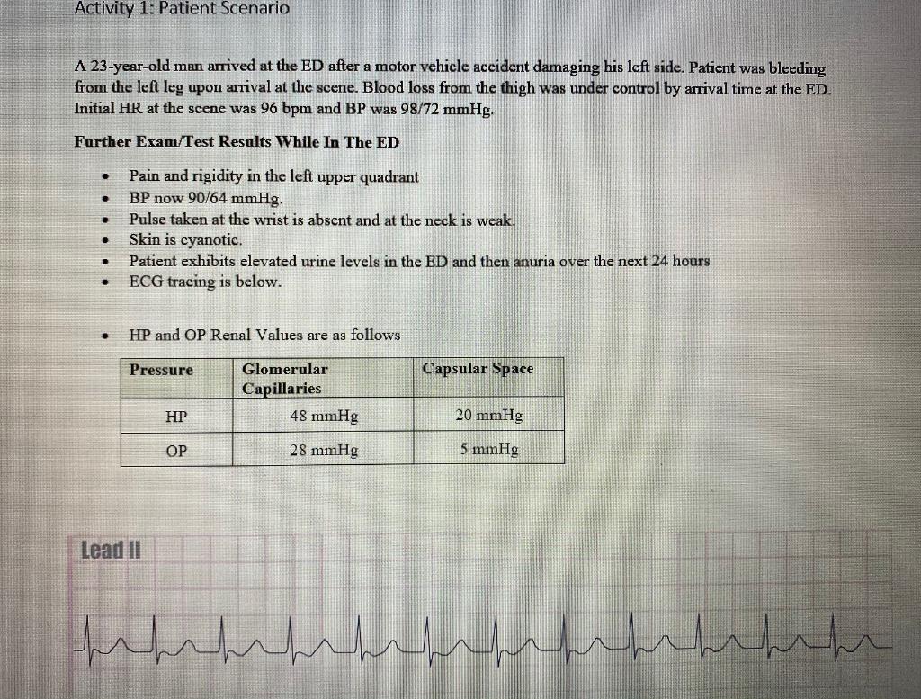 Solved Using the ECG strip, calculate your patient’s new HR