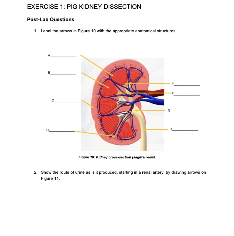 Solved EXERCISE 1 PIG KIDNEY DISSECTION PostLab Questions