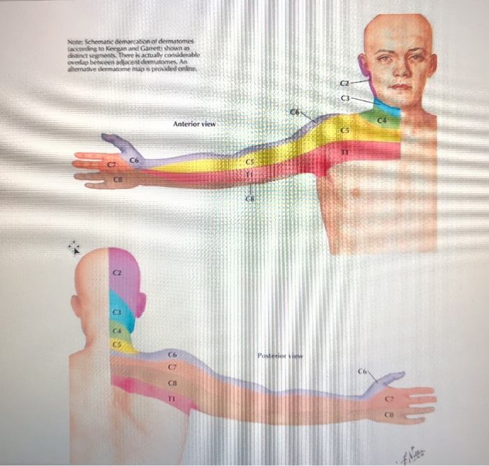 dermatomes netter