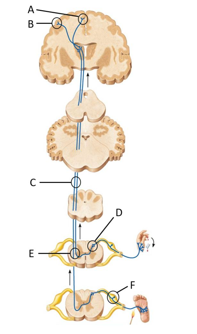 What Is A Schematic Diagram Meaning