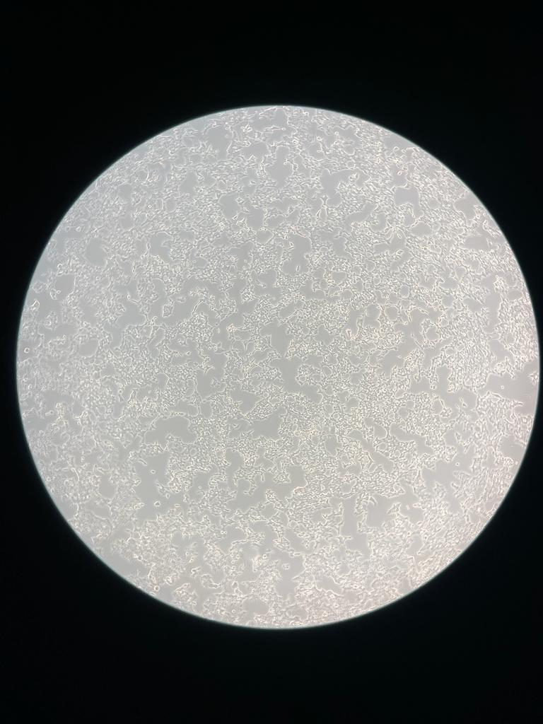 Solved DMEM media was prepared on cell culture dish (I have | Chegg.com