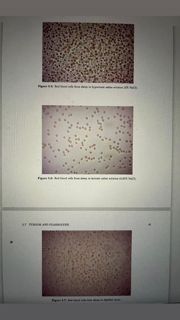 Figure 5.5: Red blood celle from sheep in hypertonic saline nolution ( \( 5 \% \) NaCl).
Figure 5.6: Red blood cells from she