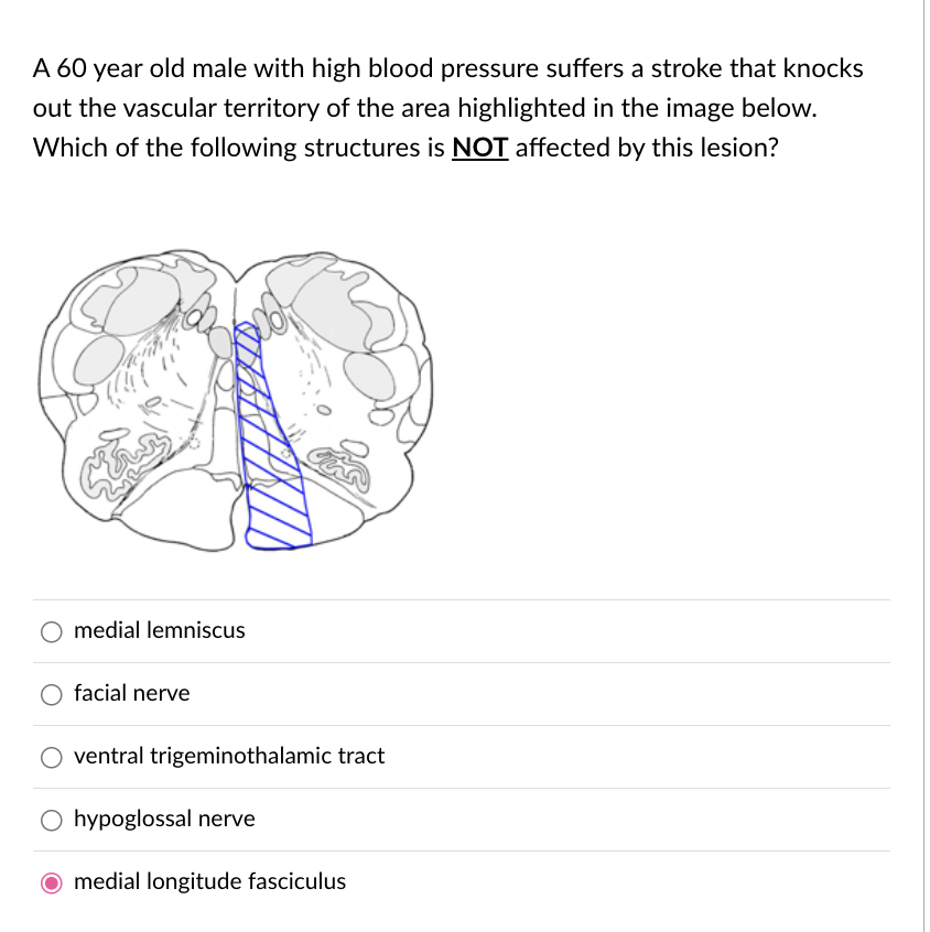 solved-a-60-year-old-male-with-high-blood-pressure-suff