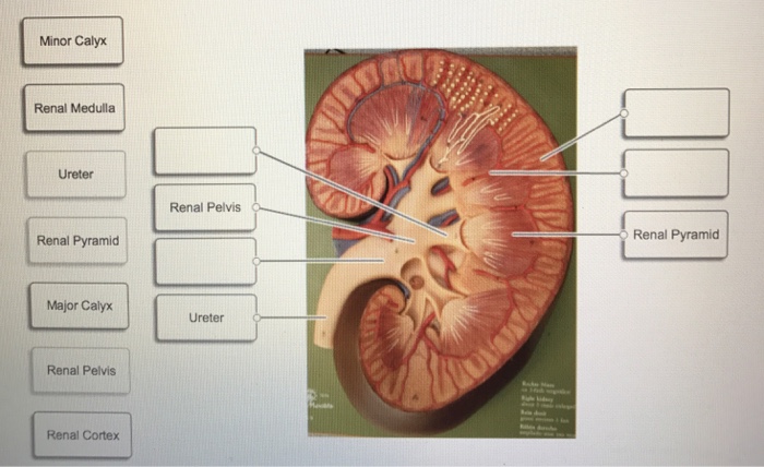 Renal Pelvis Calyx