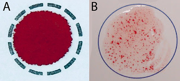 Solved Compare the normal (i.e., fresh) blood drop in Figure | Chegg.com