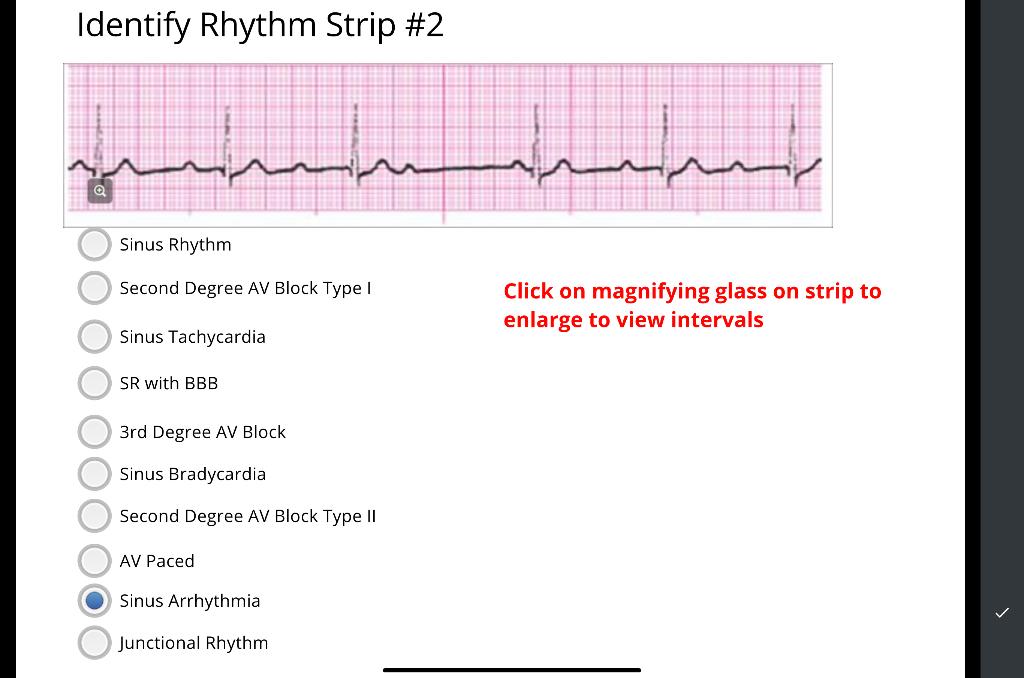 junctional bradycardia rhythm strip