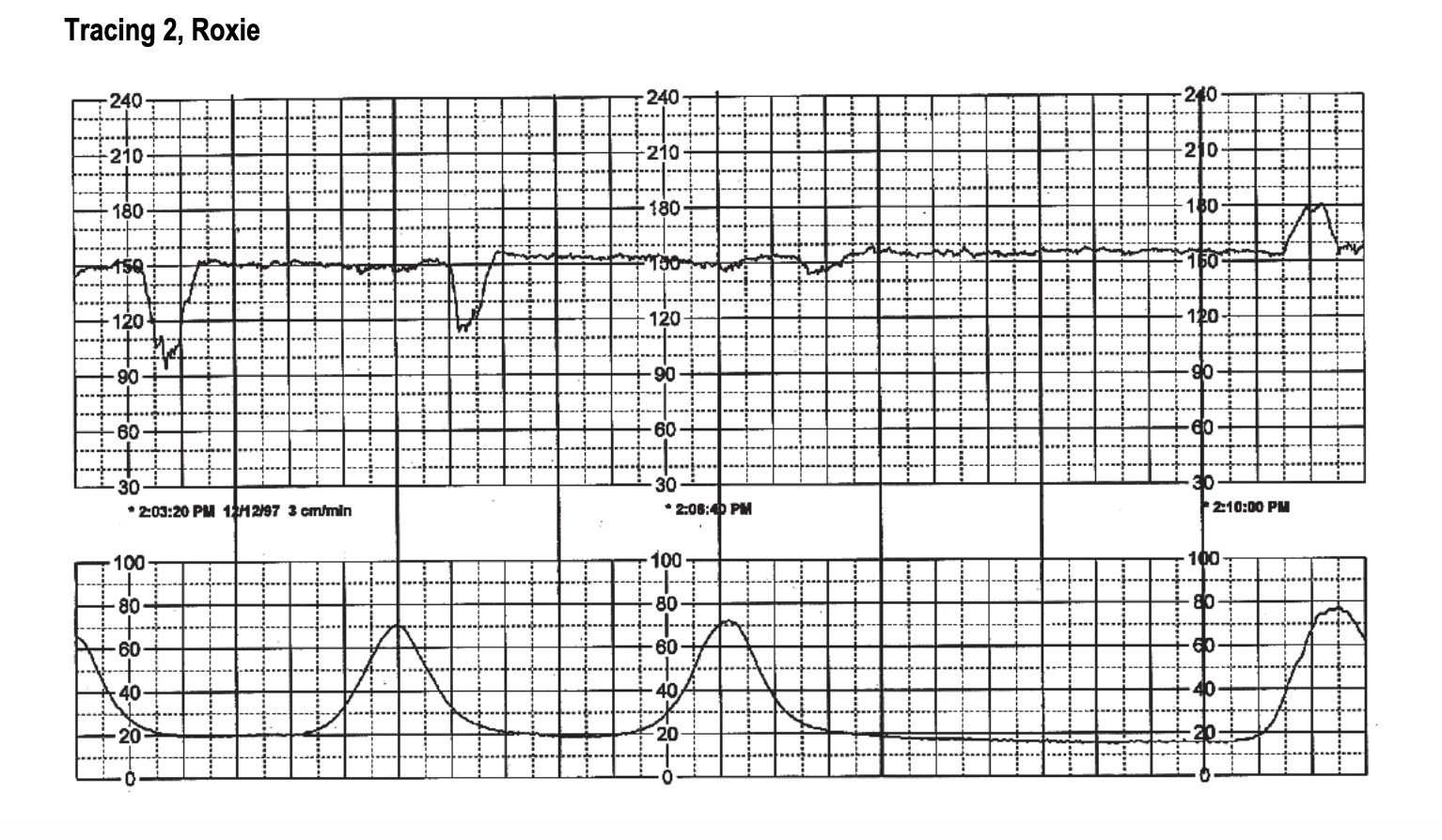 Solved Based on the 2 contractions in the middle of tracing