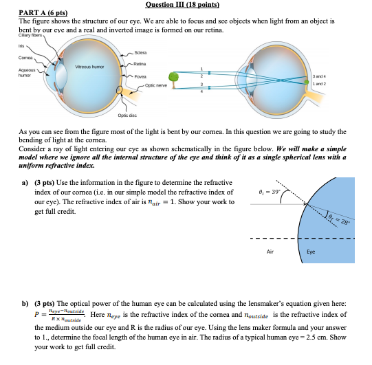 Solved Question III (18 points) PART A (6 pts) The figure | Chegg.com