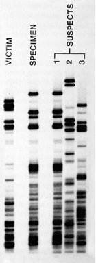 Solved: DNA Fingerprinting (profiling) Is Commonly Used As... | Chegg.com