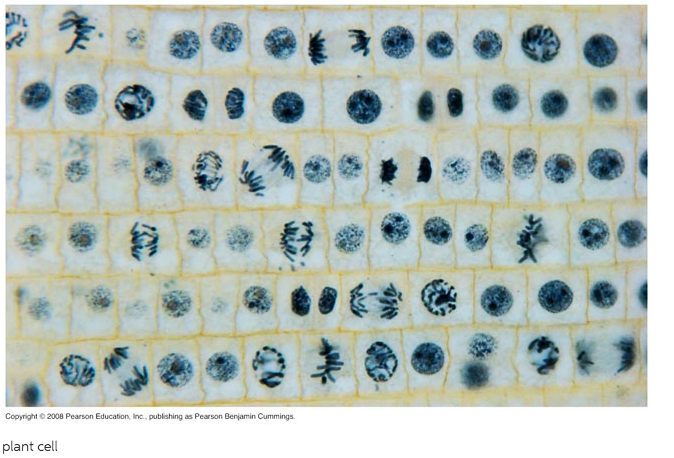 United Scientific Supplies 100-186 "Ascaris (Roundworm), Mitosis