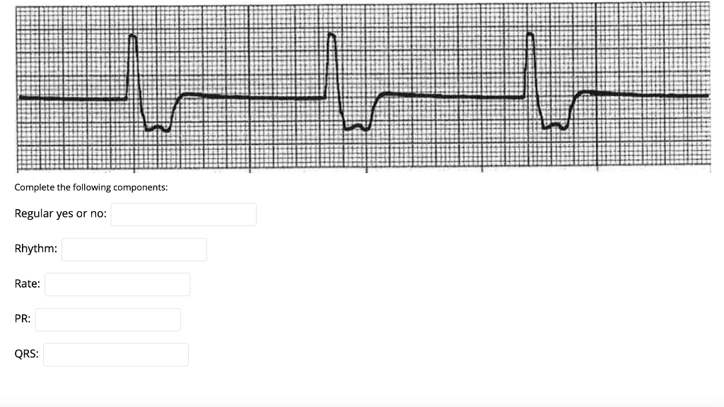 Complete the following components: Regular yes or no: Rhythm: Rate: PR: QRS: