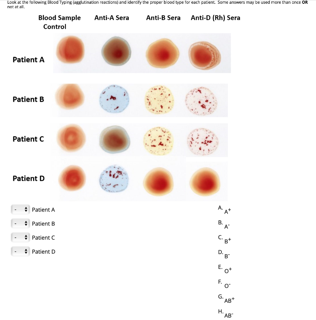 View Blood Type A Agglutination Background Blood Type