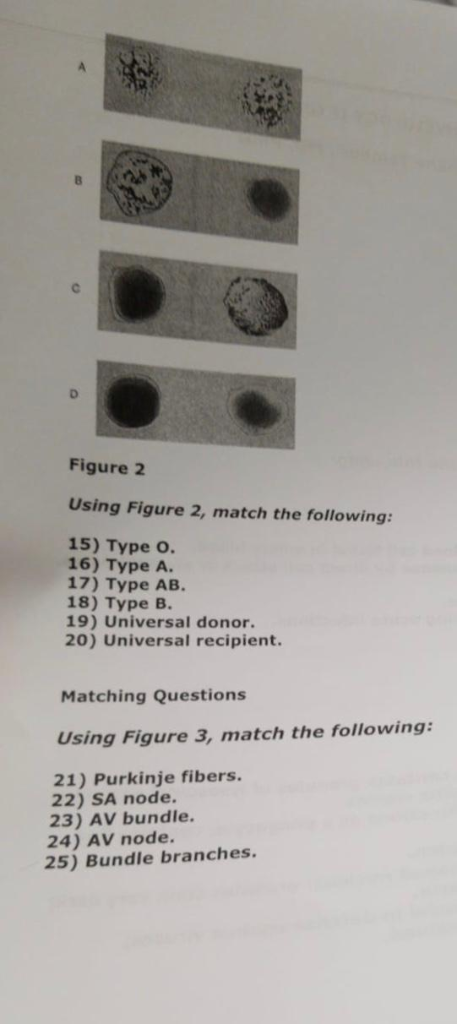 Solved Figure 2 Using Figure 2, Match The Following: 15) | Chegg.com