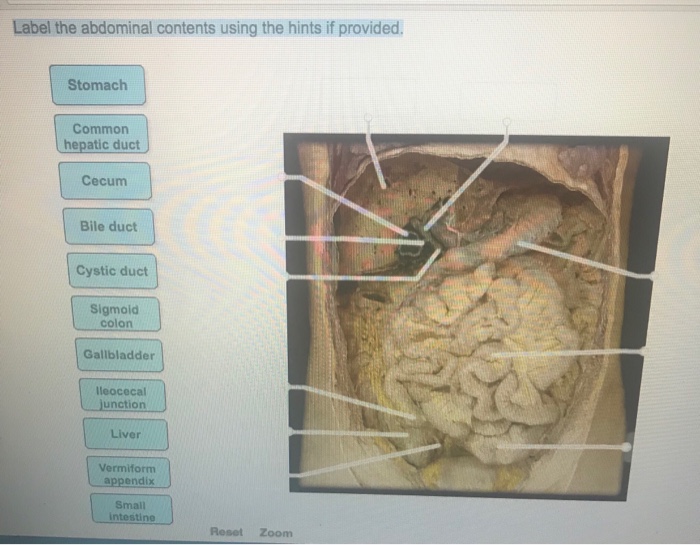 Label the Abdominal Contents Using the Hints if Provided.
