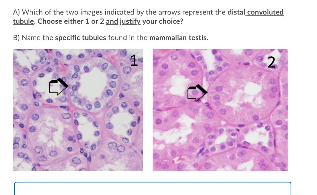 Solved A) Which of the two images indicated by the arrows | Chegg.com