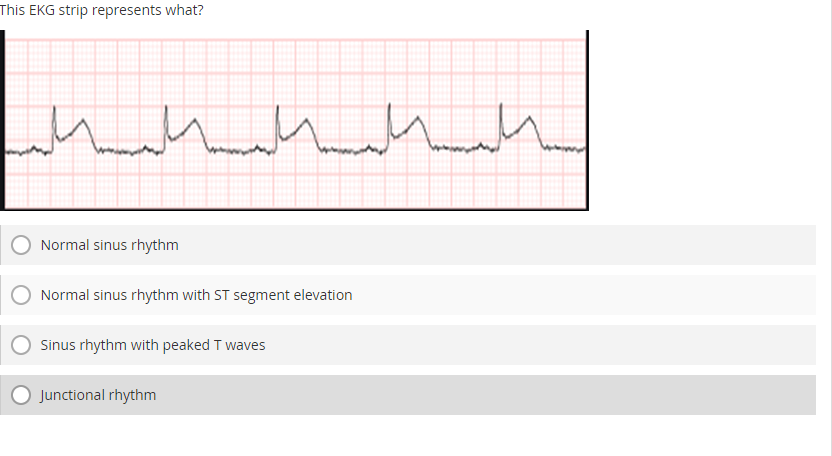 st segment elevation strip