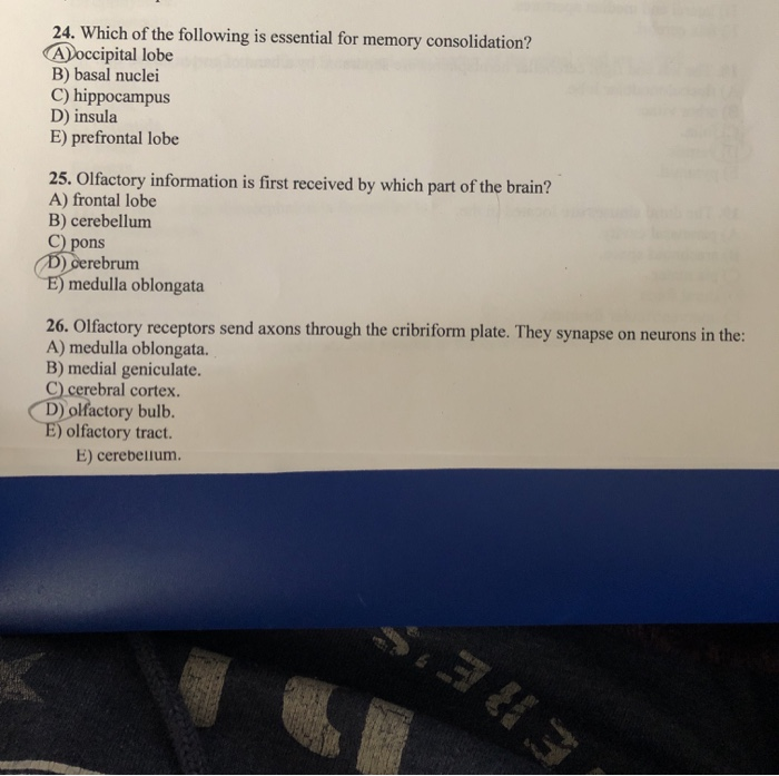 Solved 24. hfowing is essential for memory consolidation? | Chegg.com