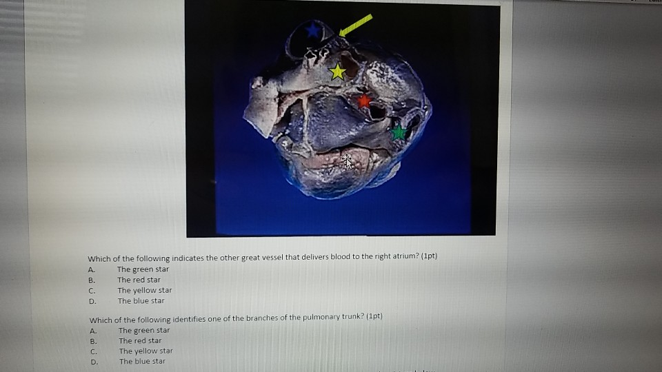 solved-which-of-the-following-indicates-the-other-great-chegg