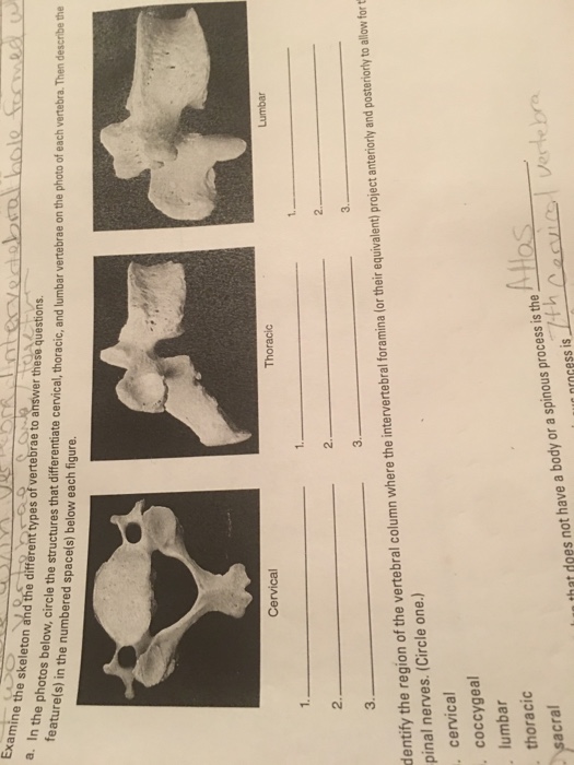 Solved In the photos below, circle the structures that | Chegg.com