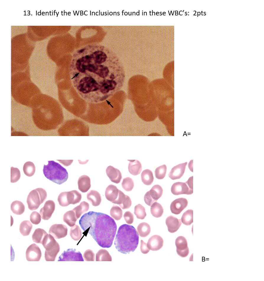 Solved 13. Identify the WBC Inclusions found in these WBC's: | Chegg.com