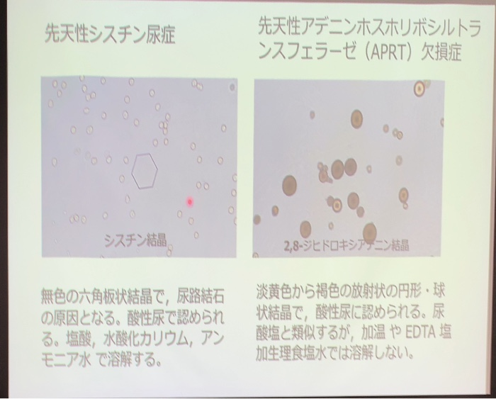 国試 検査総論 尿沈渣 Flashcards Chegg Com