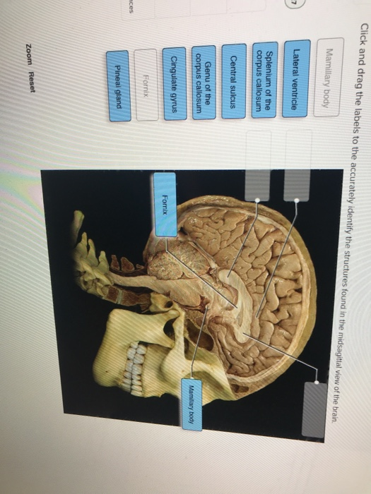 Solved Click and drag the labels to the accurately identify | Chegg.com